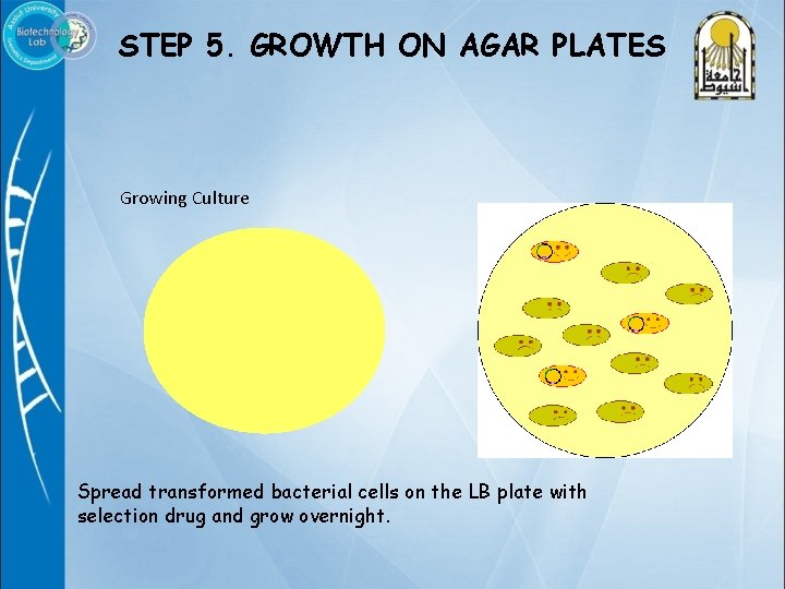 STEP 5. GROWTH ON AGAR PLATES Growing Culture Spread transformed bacterial cells on the