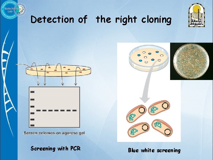Detection of the right cloning Screening with PCR Blue white screening 