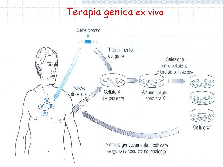 Terapia genica ex vivo 