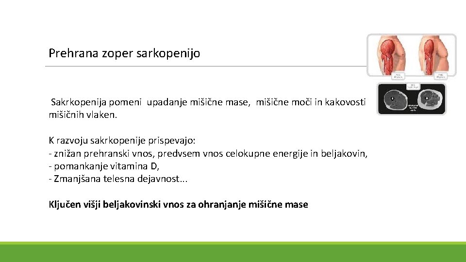 Prehrana zoper sarkopenijo Sakrkopenija pomeni upadanje mišične mase, mišične moči in kakovosti mišičnih vlaken.