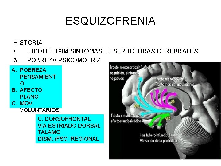 ESQUIZOFRENIA HISTORIA • LIDDLE– 1984 SINTOMAS – ESTRUCTURAS CEREBRALES 3. POBREZA PSICOMOTRIZ A. POBREZA