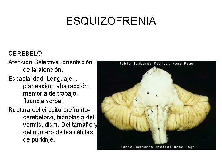 ESQUIZOFRENIA CEREBELO Atención Selectiva, orientación de la atención. Espacialidad, Lenguaje, , planeación, abstracción, memoria
