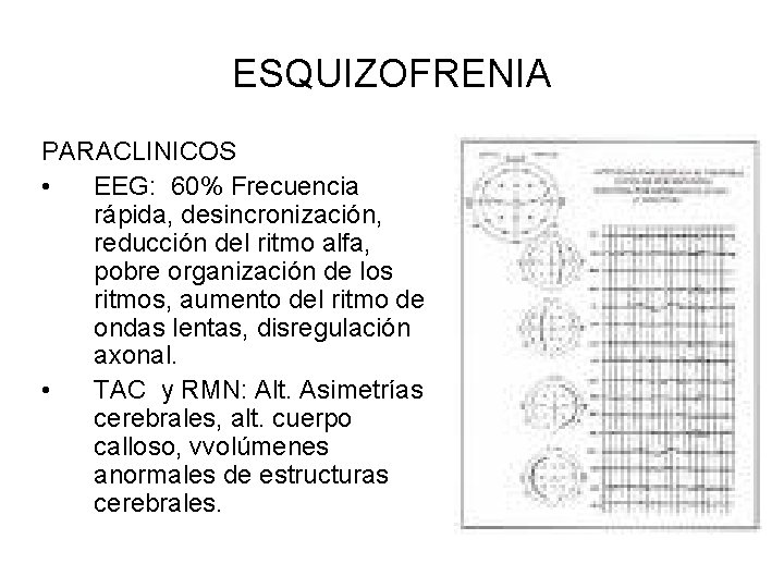ESQUIZOFRENIA PARACLINICOS • EEG: 60% Frecuencia rápida, desincronización, reducción del ritmo alfa, pobre organización