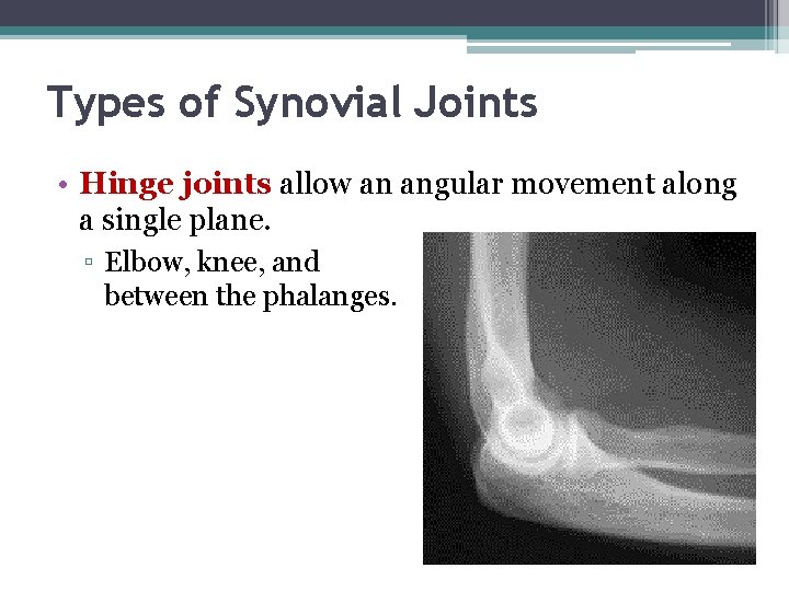 Types of Synovial Joints • Hinge joints allow an angular movement along a single