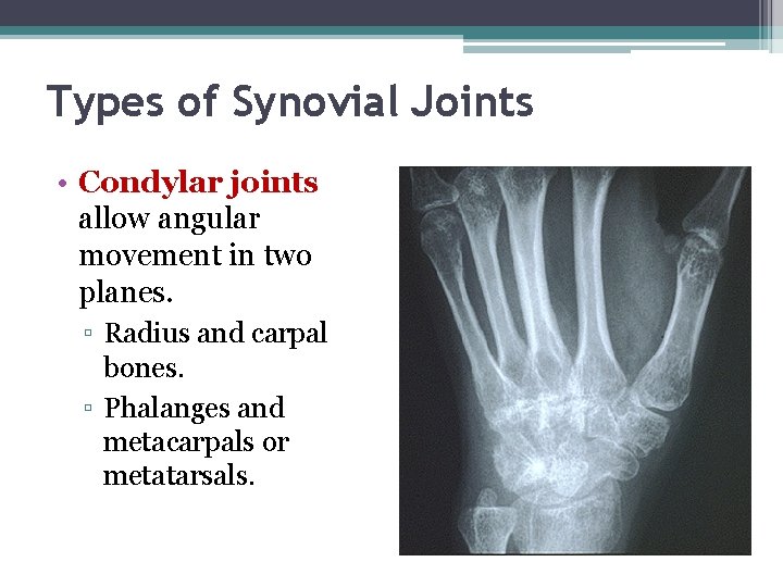 Types of Synovial Joints • Condylar joints allow angular movement in two planes. ▫