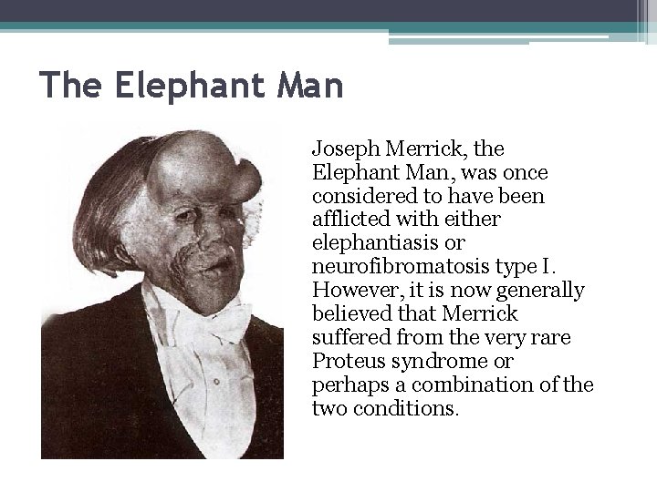 The Elephant Man Joseph Merrick, the Elephant Man, was once considered to have been