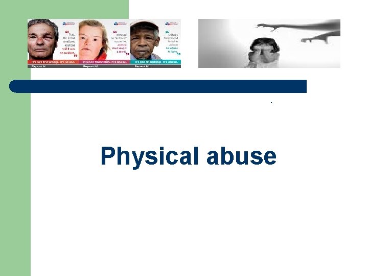 . Physical abuse 