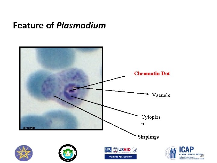 Feature of Plasmodium Chromatin Dot Vacuole Cytoplas m CCMOVBD Striplings 20 
