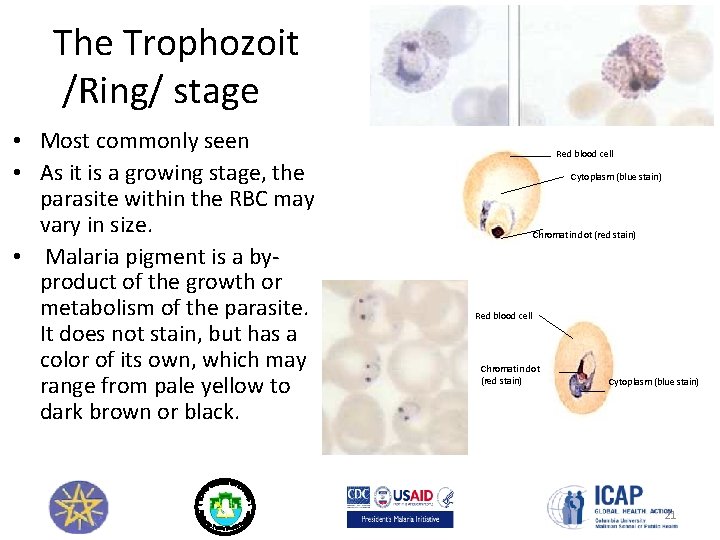The Trophozoit /Ring/ stage • Most commonly seen • As it is a growing