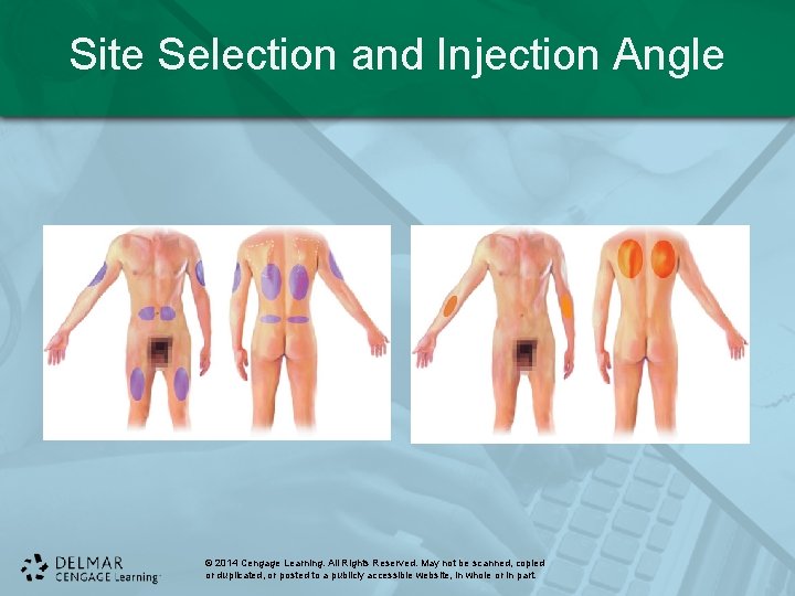 Site Selection and Injection Angle © 2014 Cengage Learning. All Rights Reserved. May not Site Selection and Injection Angle © 2014 Cengage Learning. All Rights Reserved. May not