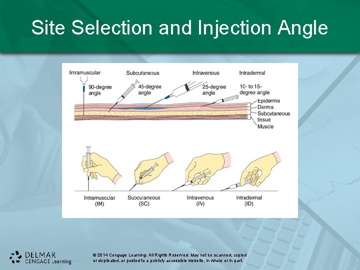 Site Selection and Injection Angle © 2014 Cengage Learning. All Rights Reserved. May not Site Selection and Injection Angle © 2014 Cengage Learning. All Rights Reserved. May not