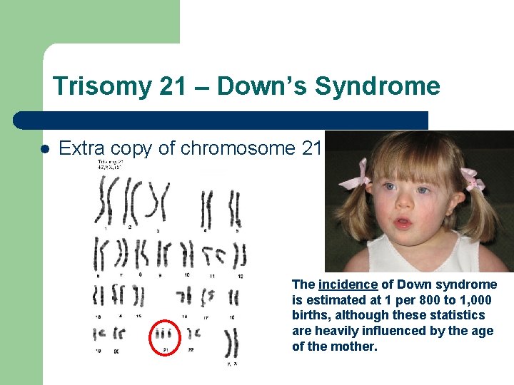 Trisomy 21 – Down’s Syndrome l Extra copy of chromosome 21 The incidence of