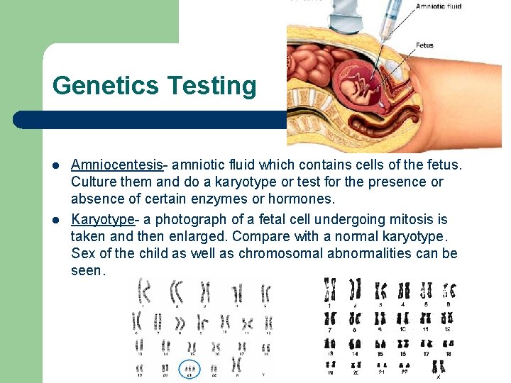 Genetics Testing l l Amniocentesis- amniotic fluid which contains cells of the fetus. Culture