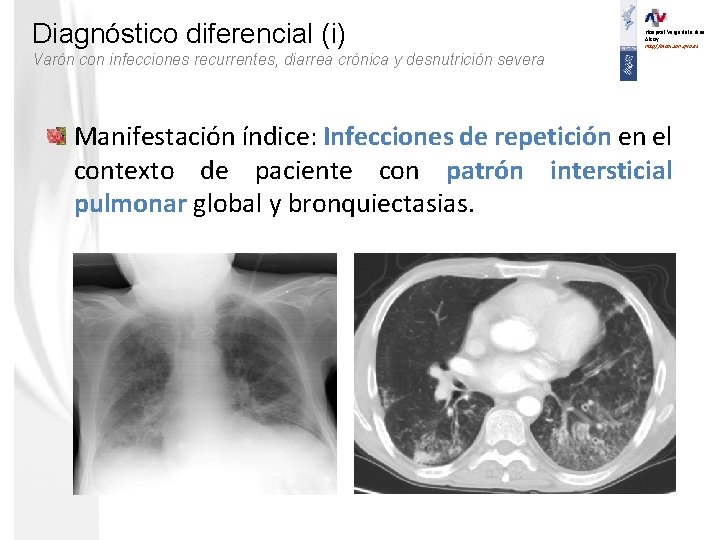 Diagnóstico diferencial (i) Hospital Verge dels Lliris. Alcoy. http//alcoi. san. gva. es Varón con