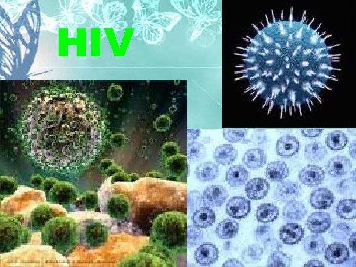 HIV 