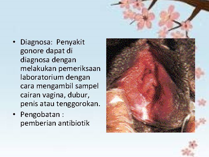  • Diagnosa: Penyakit gonore dapat di diagnosa dengan melakukan pemeriksaan laboratorium dengan cara