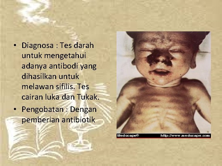  • Diagnosa : Tes darah untuk mengetahui adanya antibodi yang dihasilkan untuk melawan