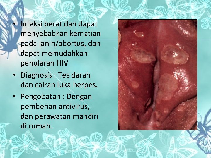  • Infeksi berat dan dapat menyebabkan kematian pada janin/abortus, dan dapat memudahkan penularan