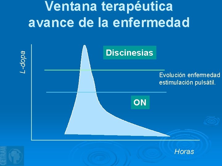 L-dopa Ventana terapéutica avance de la enfermedad Discinesias Evolución enfermedad estimulación pulsátil. ON Horas