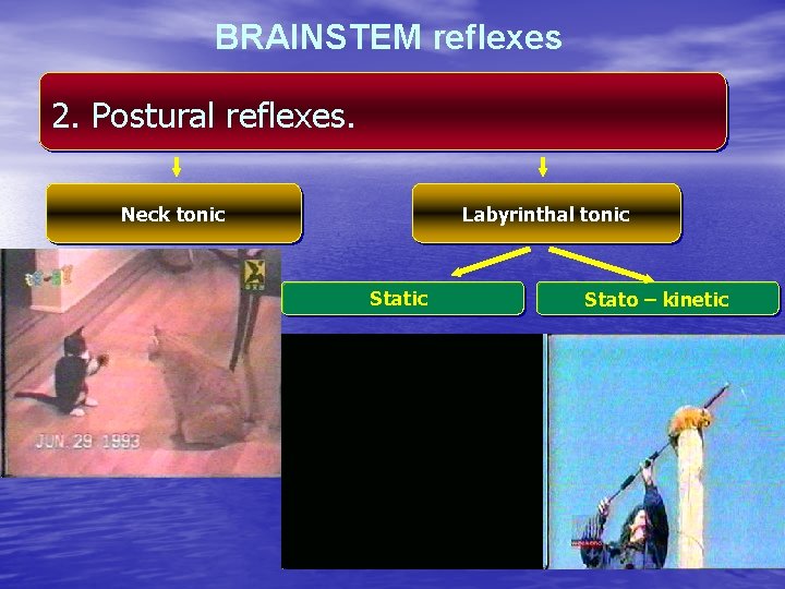 BRAINSTEM reflexes 2. Postural reflexes. Neck tonic Labyrinthal tonic Stato – kinetic 