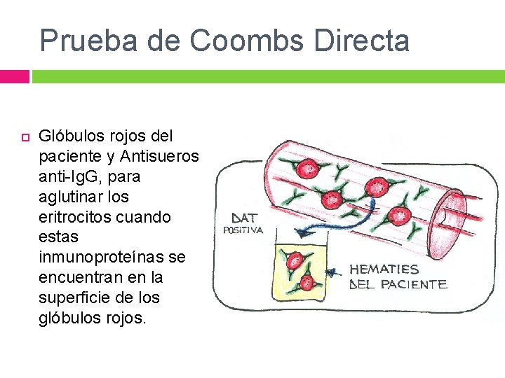 Prueba de Coombs Directa Glóbulos rojos del paciente y Antisueros anti-Ig. G, para aglutinar Prueba de Coombs Directa Glóbulos rojos del paciente y Antisueros anti-Ig. G, para aglutinar