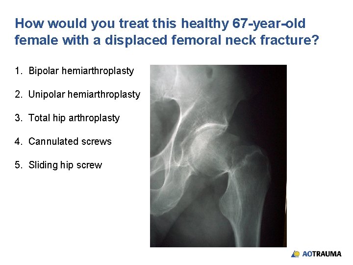 How would you treat this healthy 67 -year-old female with a displaced femoral neck