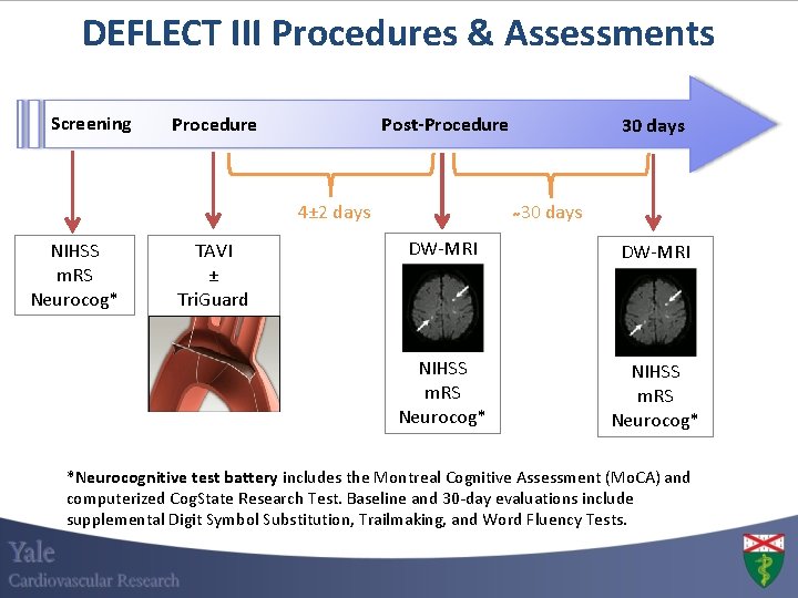 DEFLECT III Procedures & Assessments Screening Post-Procedure 4± 2 days NIHSS m. RS Neurocog*