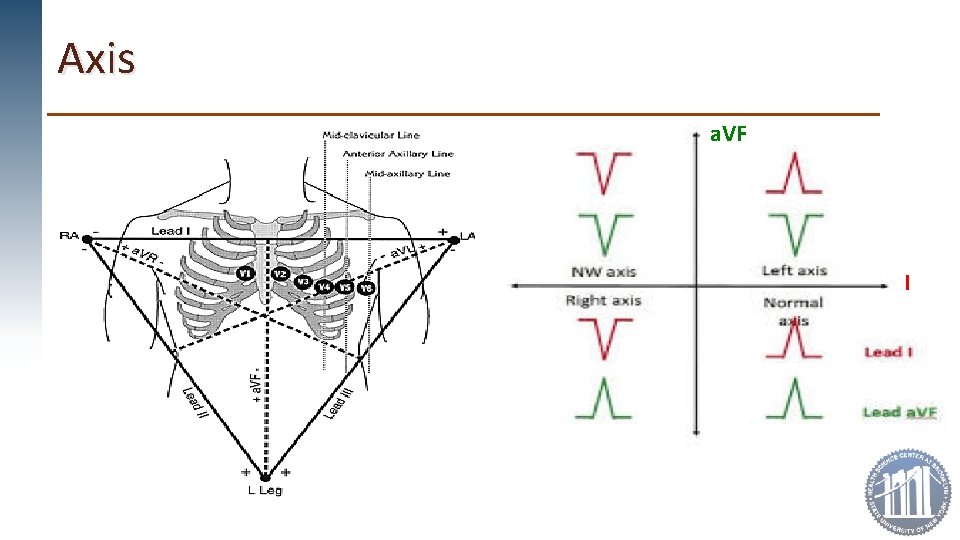 Axis a. VF I 