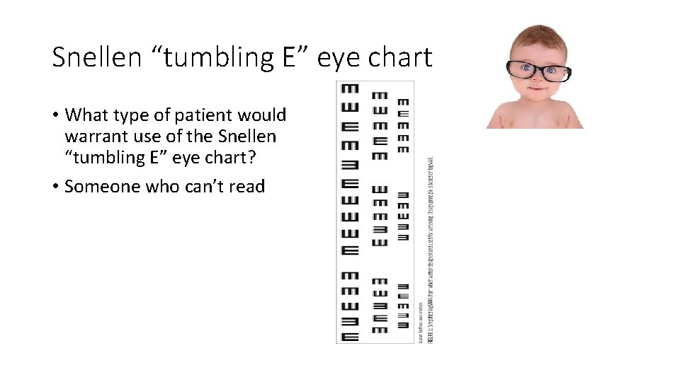 Snellen “tumbling E” eye chart • What type of patient would warrant use of