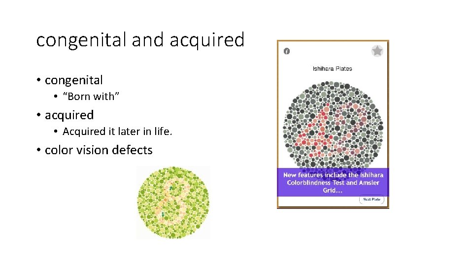 congenital and acquired • congenital • “Born with” • acquired • Acquired it later