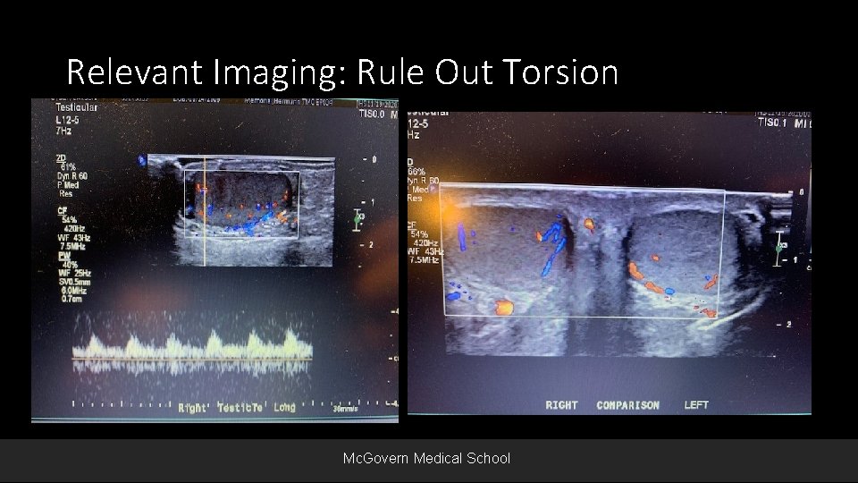 Relevant Imaging: Rule Out Torsion Mc. Govern Medical School 