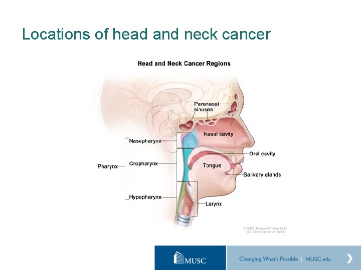 Locations of head and neck cancer 