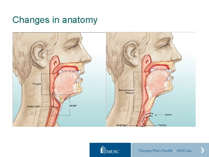 Changes in anatomy 