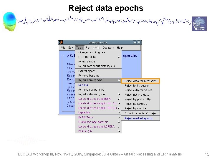 Reject Analysis Database Artifact processing and ERP analysis Task 1 Reject