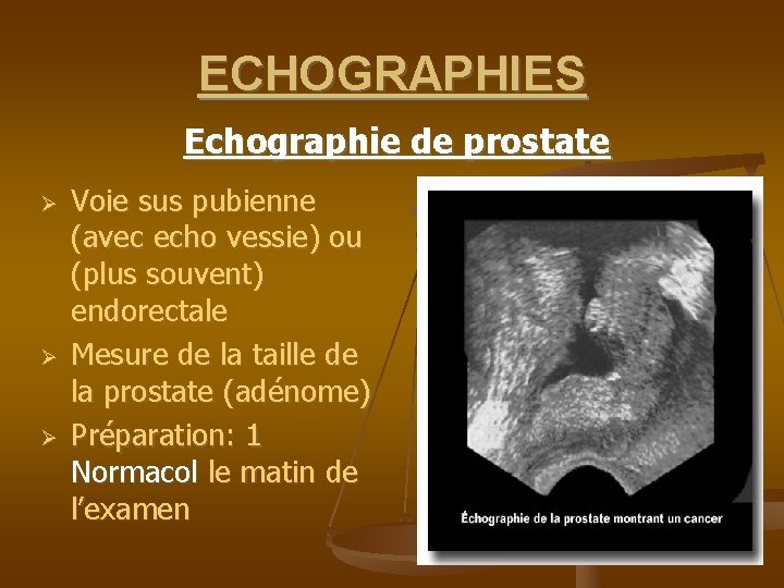 UROLOGIENEPHROLOGIE EXAMENS COMPLEMENTAIRES EXAMENS RADIOLOGIQUES AUSP urologienephrologie-examens-complementaires-examens-radiologiques-ausp