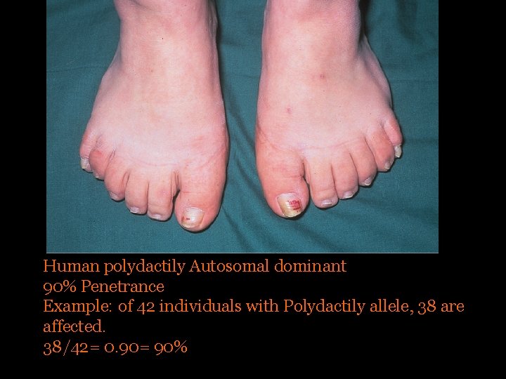 Human polydactily Autosomal dominant 90% Penetrance Example: of 42 individuals with Polydactily allele, 38