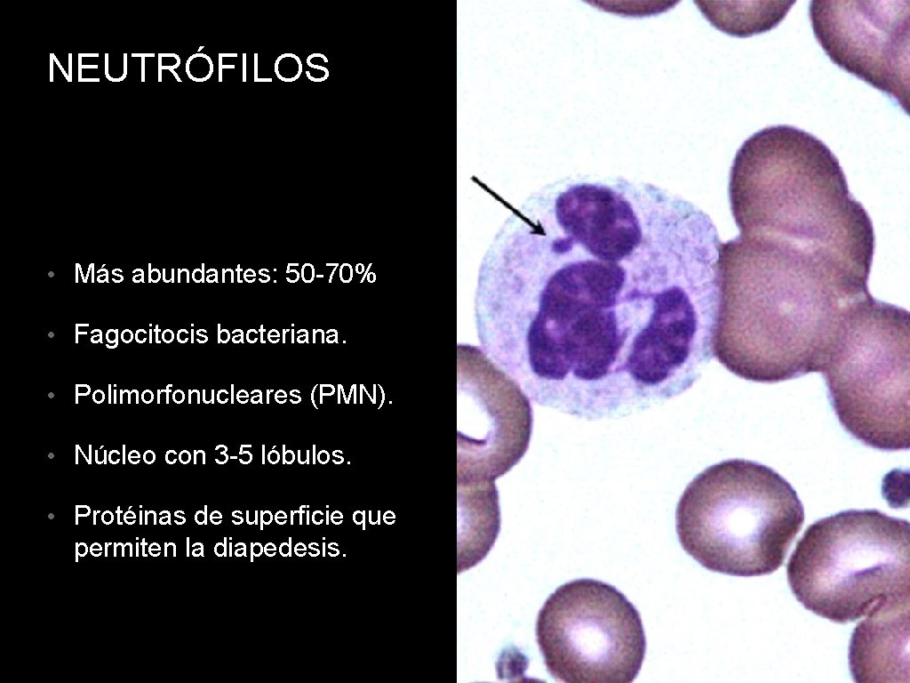 NEUTRÓFILOS • Más abundantes: 50 -70% • Fagocitocis bacteriana. • Polimorfonucleares (PMN). • Núcleo