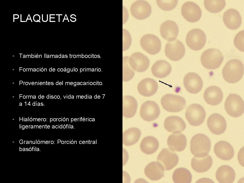 PLAQUETAS • También llamadas trombocitos. • Formación de coágulo primario. • Provenientes del megacariocito.