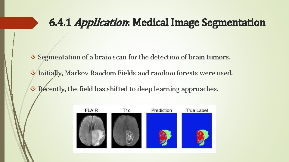 6. 4. 1 Application: Medical Image Segmentation of a brain scan for the detection