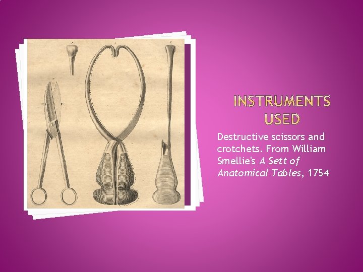 Destructive scissors and crotchets. From William Smellie's A Sett of Anatomical Tables, 1754 