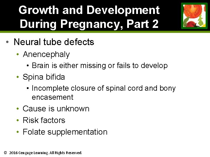 Growth and Development During Pregnancy, Part 2 • Neural tube defects • Anencephaly • Growth and Development During Pregnancy, Part 2 • Neural tube defects • Anencephaly •