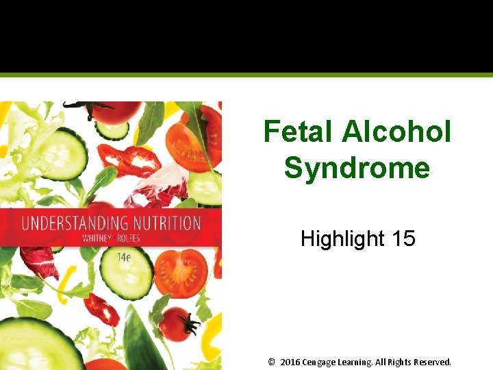Fetal Alcohol Syndrome Highlight 15 © 2016 Cengage Learning. All Rights Reserved. Fetal Alcohol Syndrome Highlight 15 © 2016 Cengage Learning. All Rights Reserved.