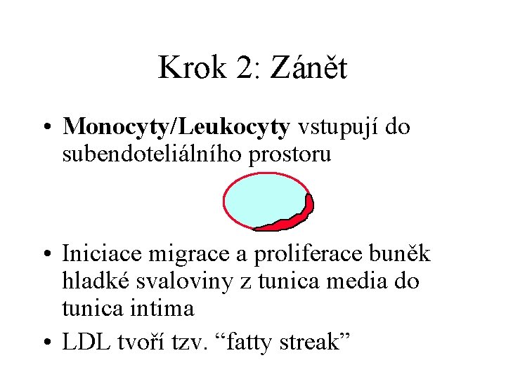 Krok 2: Zánět • Monocyty/Leukocyty vstupují do subendoteliálního prostoru • Iniciace migrace a proliferace