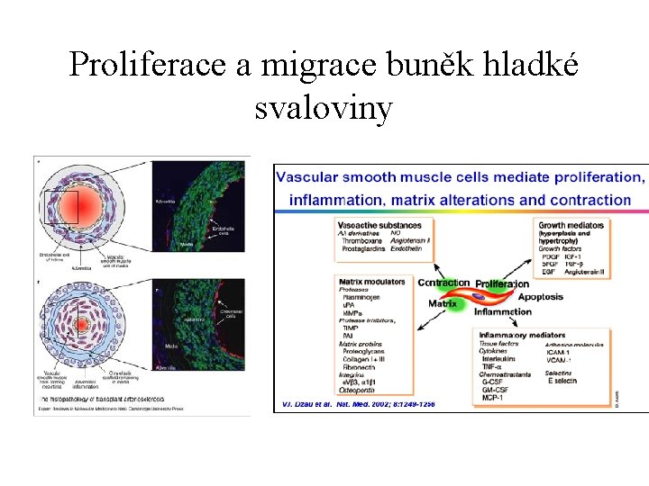 Proliferace a migrace buněk hladké svaloviny 