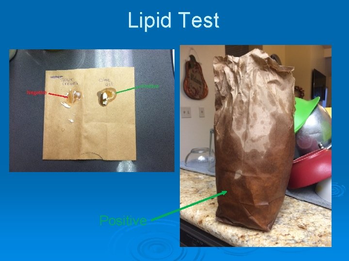Lipid Test Positive 