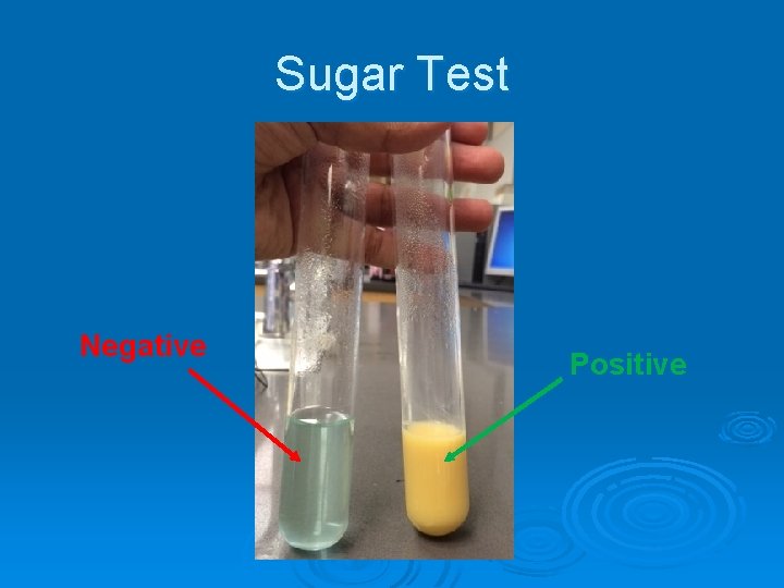 Sugar Test Negative Positive 