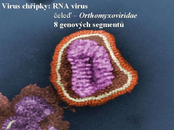 Virus chřipky: RNA virus čeleď – Orthomyxoviridae 8 genových segmentů 