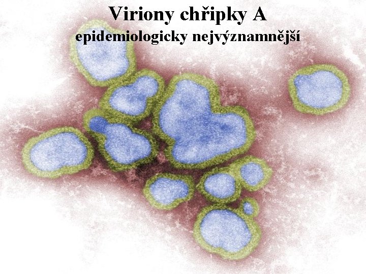 Viriony chřipky A epidemiologicky nejvýznamnější 