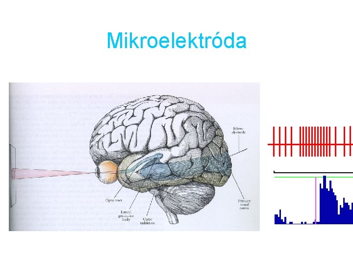Mikroelektróda 