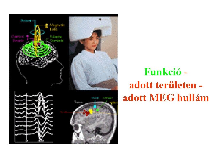 Funkció adott területen adott MEG hullám 